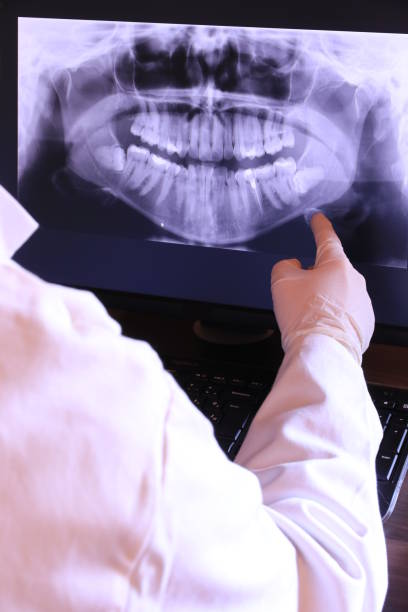 Best Emergency Root Canal Treatment in Woodbury, NY
