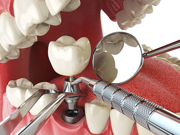 Best Pediatric Emergency Dentist in Woodbury, NY